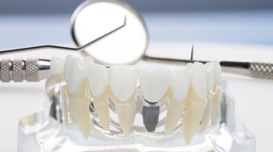 Odontología General